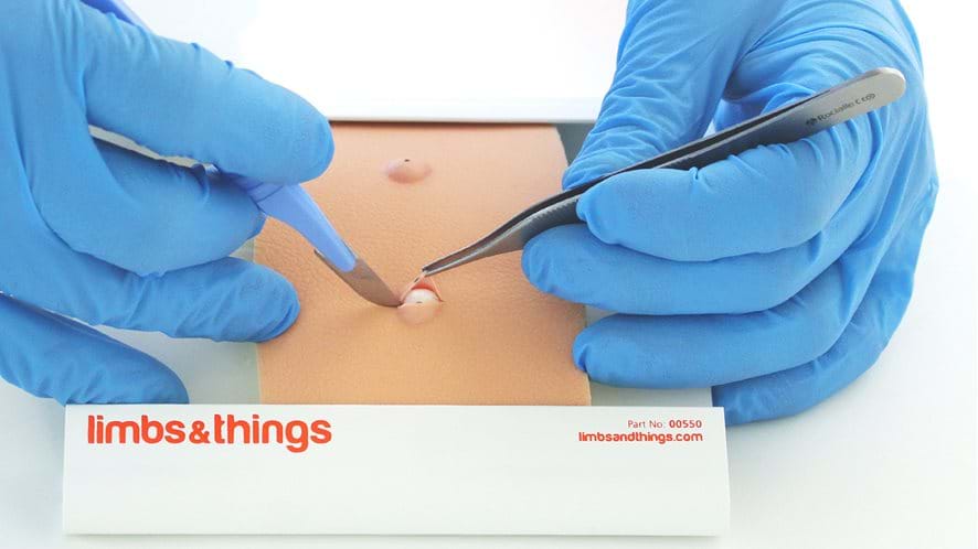 Sebaceous Cyst Pad