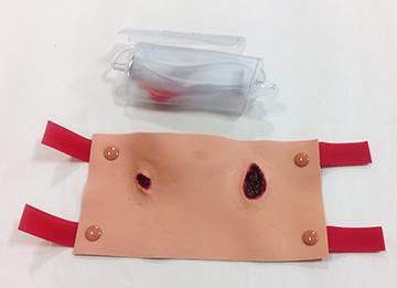 Projectile Entry & Exit Of Arm