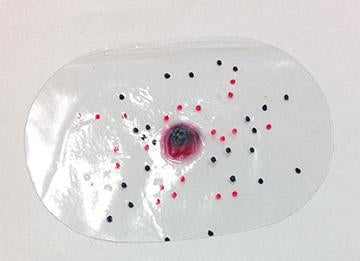 Intermediate Wound Round