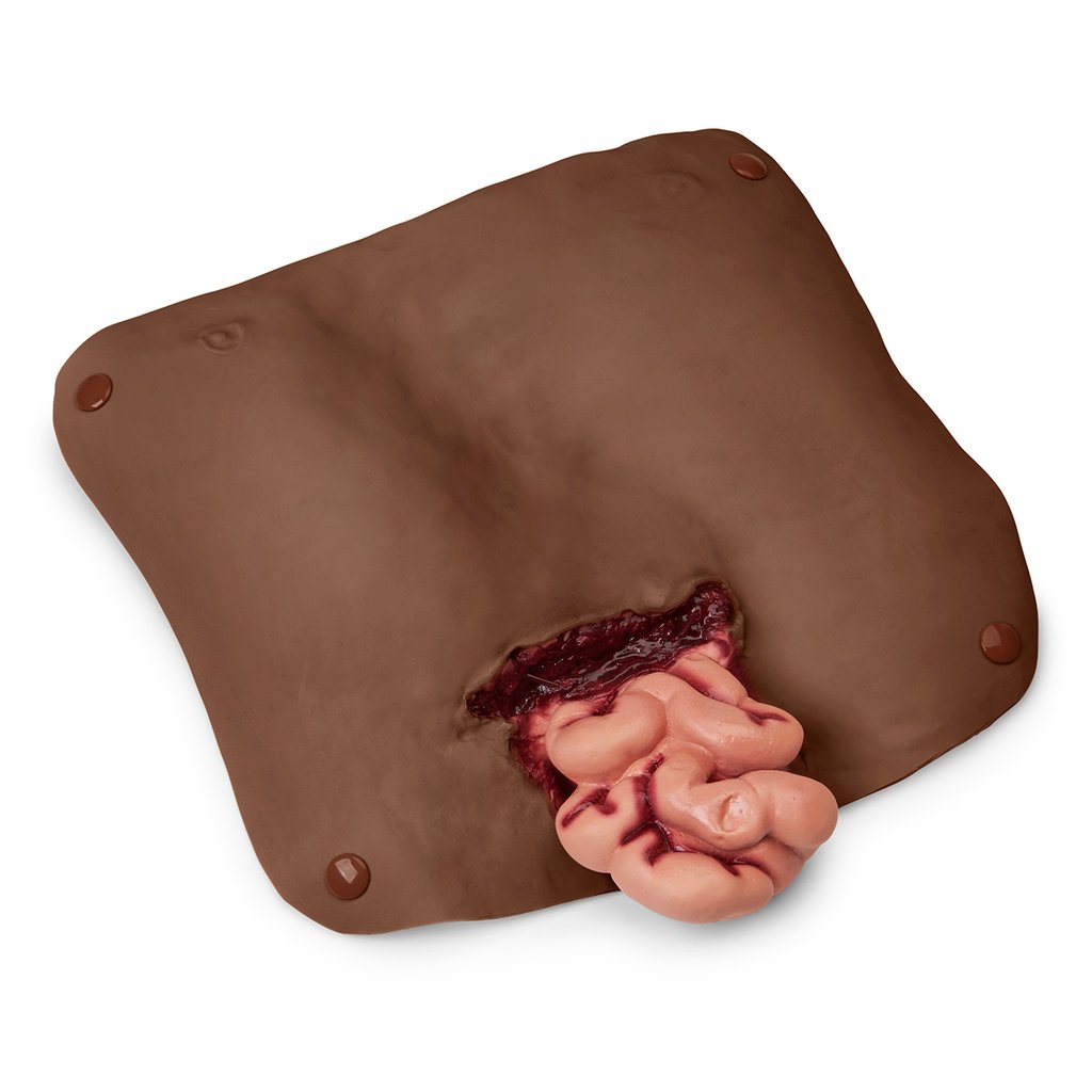 Afro Amer Abdominal Wound