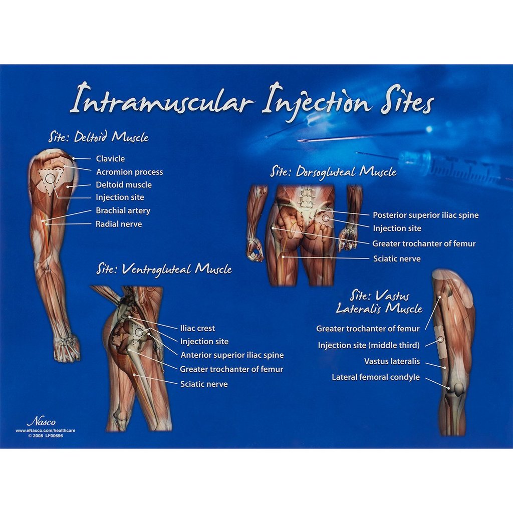 Im Injection Sites Chart Im Injection Sites Chart