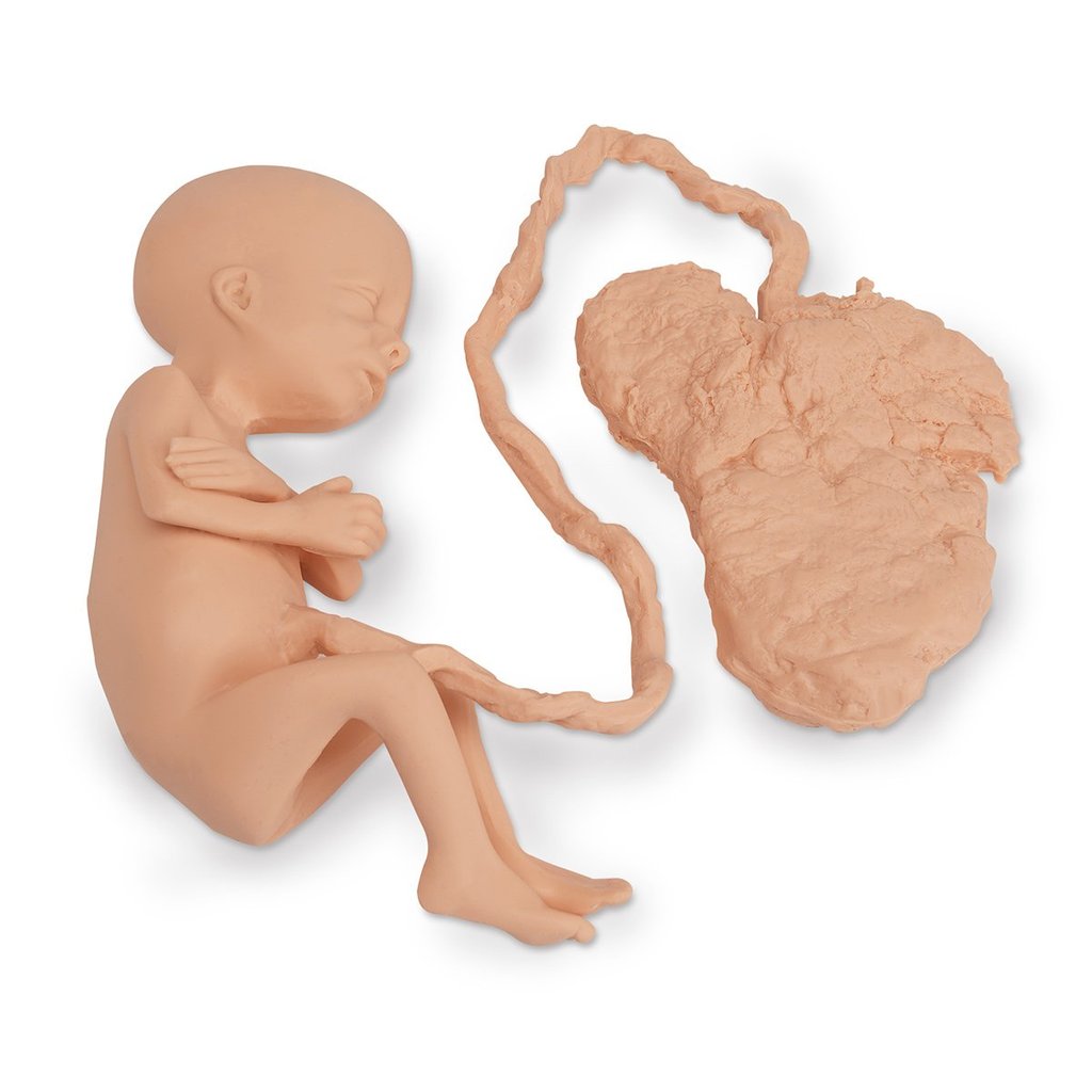 Fetus 7 Mnth Fem W/Placnta