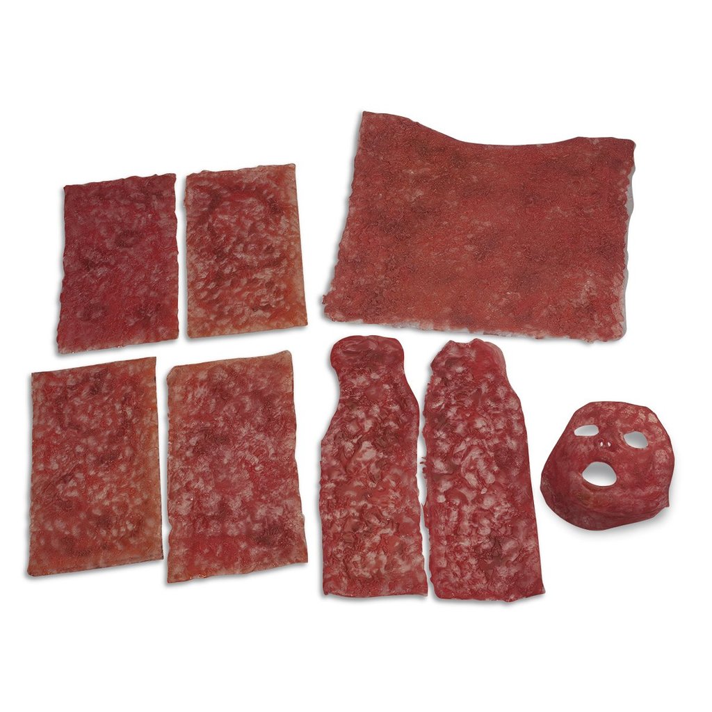 Burns Legs Arms Chest Face