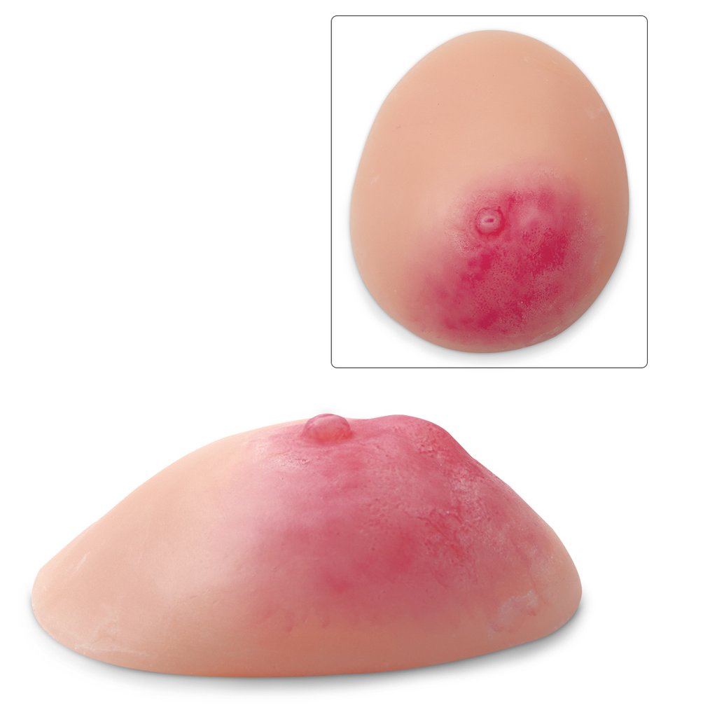 Replica Mastitis Breast