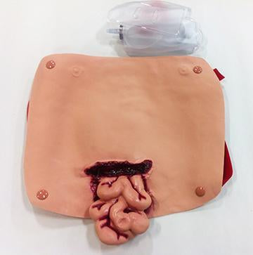 Abdominal W/Protruding Intest