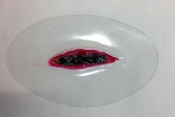 Double Edge Wound