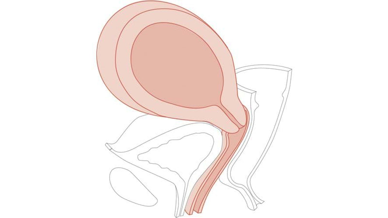 CFPT Module 7: 14 - 16 Weeks Pregnant