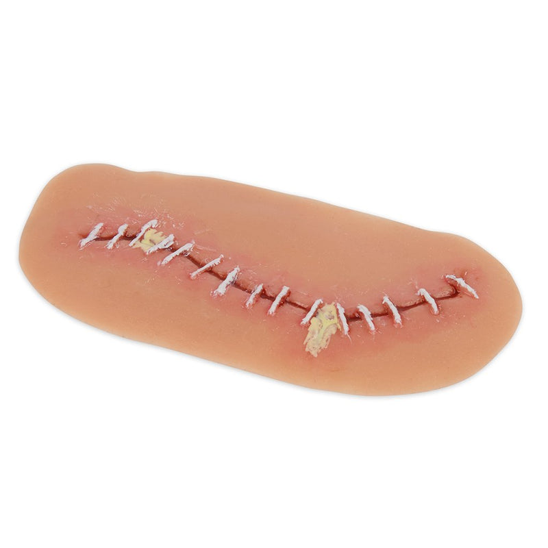Surgical Site Infection Level1