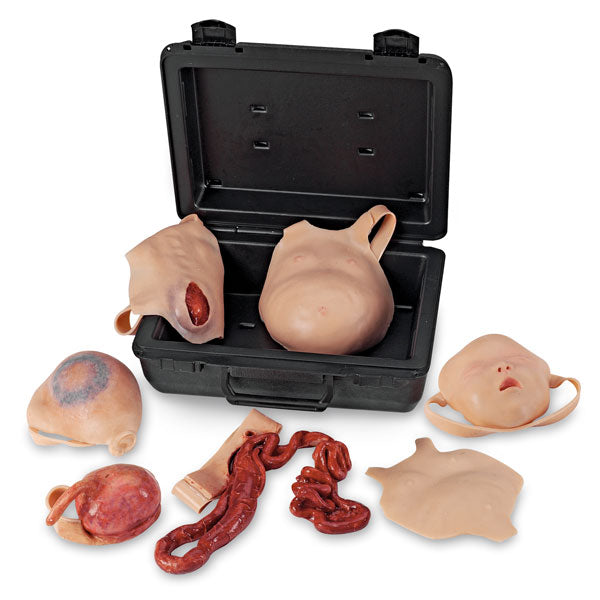 Neonatal Wound Kit