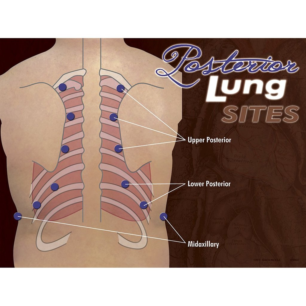 Posterior Auscltatn Poster