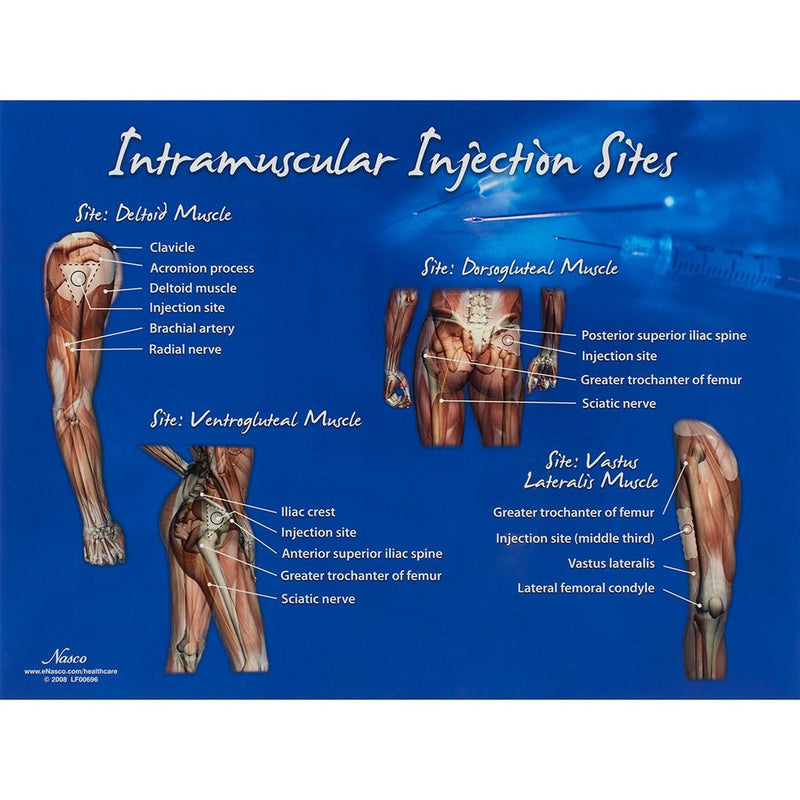 Im Injection Sites Chart