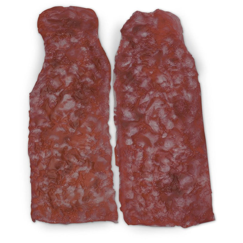 Wound Arm Burn Set 2