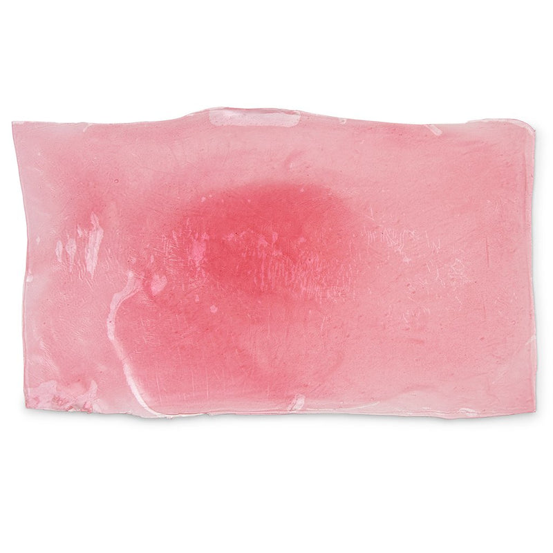 Cellulitis
