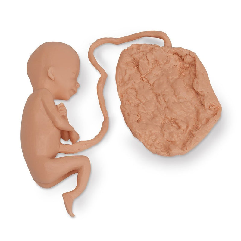 Fetus 20 Week