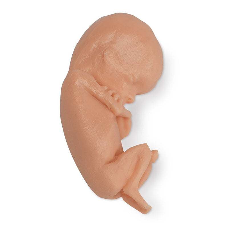 Fetus 13 Week