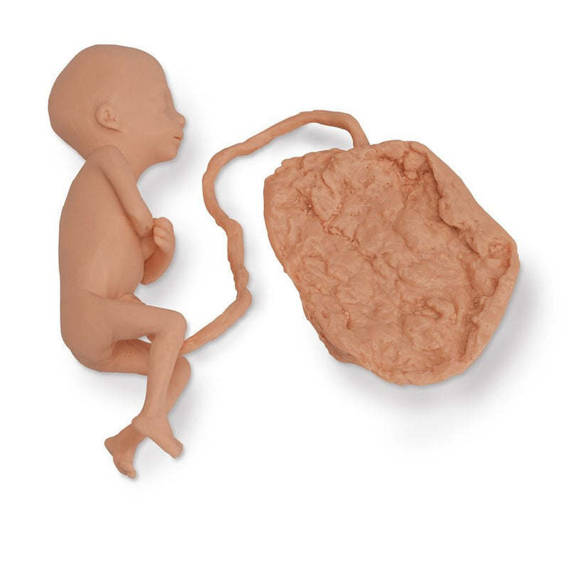 Fetus 5 Month Female