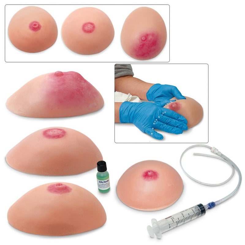 Replicas Breast Set Of 4