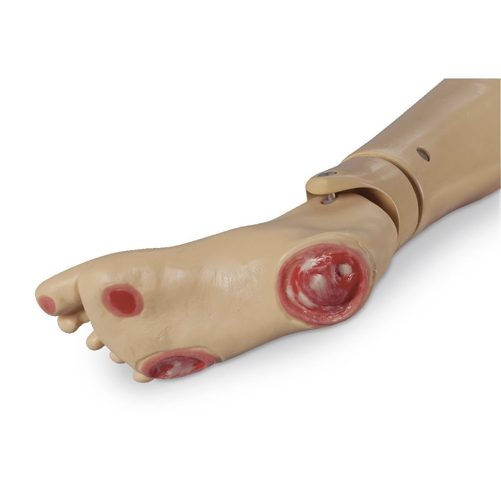 Foot Pressr Injury Lght