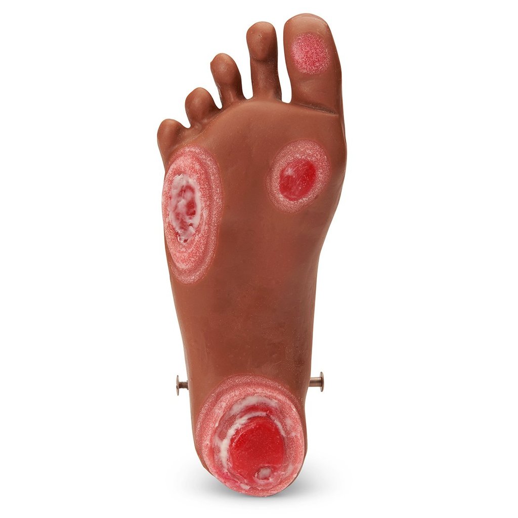 Foot Pressr Injury Med