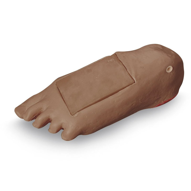 Foot Edema Geri/Keri Medm